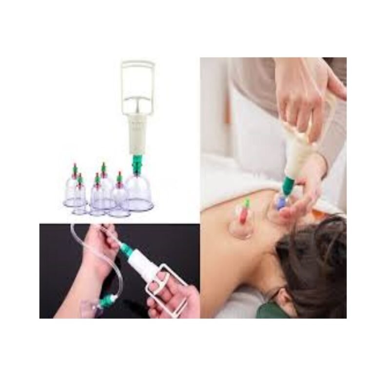 realeshop-syskeyi-me-ventoyzes-2